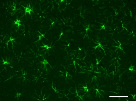 Alexa Fluor® 488 anti-GFAP