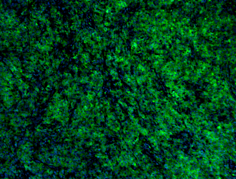 Alexa Fluor® 488 anti-HMB-45