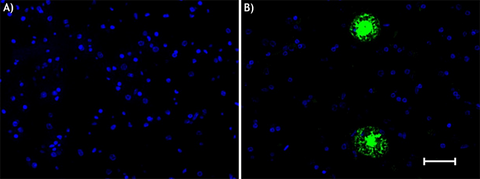 Alexa Fluor® 488 anti-β-Amyloid, 17-24