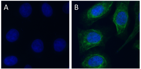 Alexa Fluor® 488 anti-Cytokeratin 17