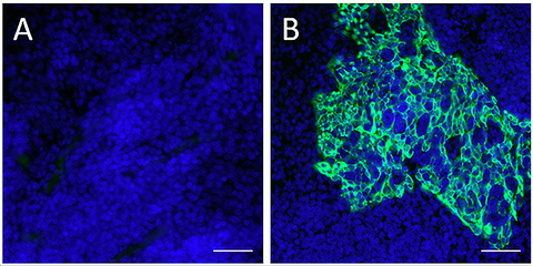 Alexa Fluor® 488 anti-Pan-Cytokeratin