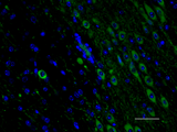 Alexa Fluor® 488 anti-Tyrosine Hydroxylase