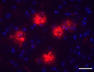 Alexa Fluor® 594 anti-β-Amyloid, 1-16