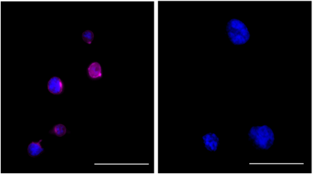 Alexa Fluor® 594 anti-ZAP70 Phospho (Tyr319)/Syk Phospho (Tyr352)