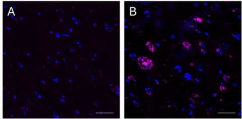 Alexa Fluor® 647 anti-β-Amyloid, 1-16 Recombinant