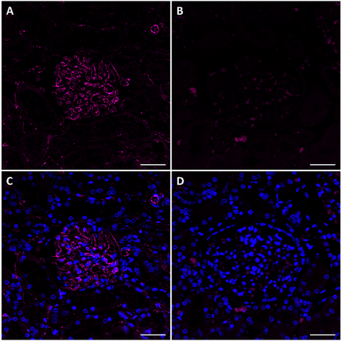 Alexa Fluor® 647 anti-CD31 (PECAM-1)