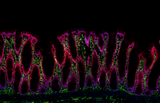 Alexa Fluor® 647 anti-human CD171 (L1CAM)