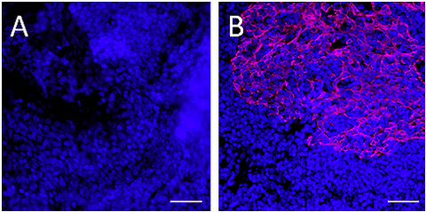 Alexa Fluor® 647 anti-Pan-Cytokeratin
