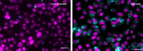 Autophagy Detection Probe Blue