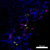 PE anti-human CD35